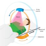 CT scan method