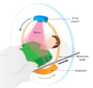 CT scan method