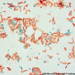 Number of endospores in a laboratory sample