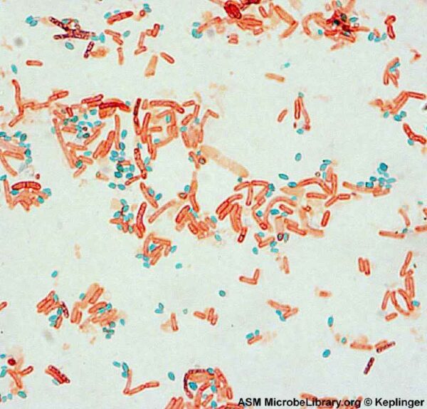 Number of endospores in a laboratory sample