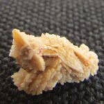 kidney stones