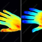 Hand thermogram of a healthy person before smoking (left) and after smoking (right)